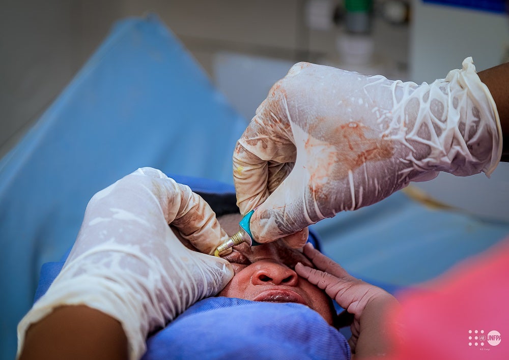 Une sage-femme administre les premiers soins oculaires à un nouveau-né pour prévenir les infections